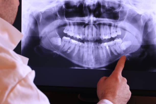 Best Broken or Cracked Tooth Emergency Dentist in Nappanee, IN