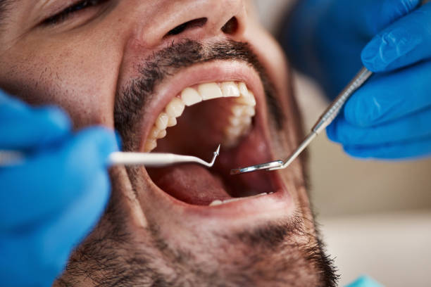 Best Emergency Root Canal Treatment in Nappanee, IN