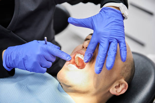 Best Emergency Dentist for Lost Fillings or Crowns in Nappanee, IN